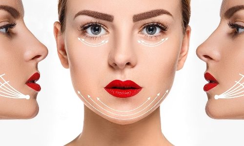 Căng chỉ collagen được bao lâu? Làm gì để duy trì làn da đẹp