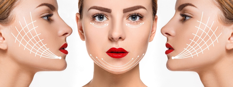 Căng chỉ collagen được bao lâu? Làm gì để duy trì làn da đẹp