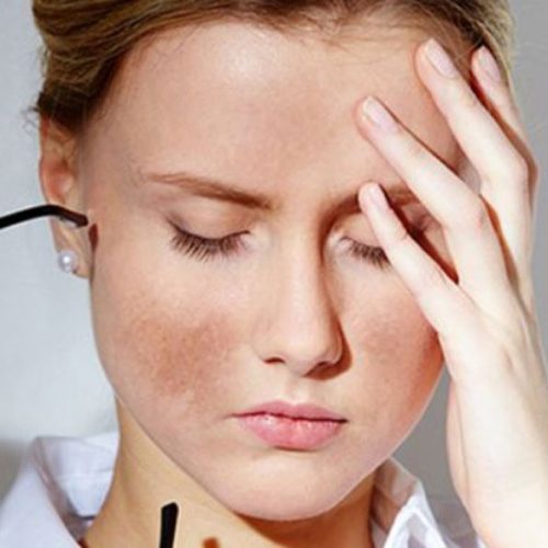 Hướng dẫn cách chăm sóc da mặt bị sạm đen đúng chuẩn