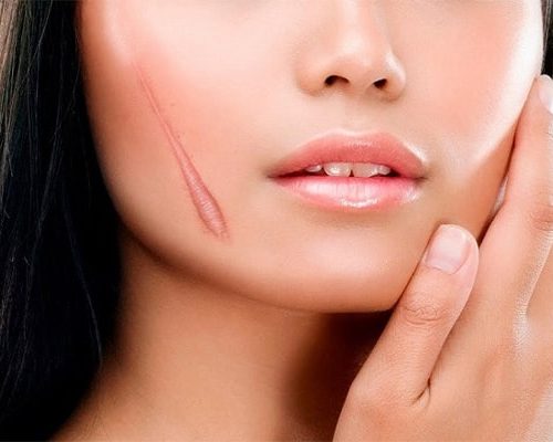 vết thương lên da non bị thâm - Nguyên nhân và cách khắc phục