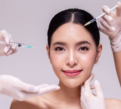 Tiêm căng bóng da duy trì được bao lâu