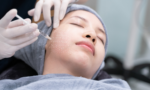 Công nghệ làm đẹp da mesotherapy là gì