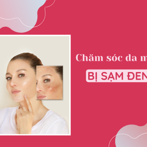 Hướng dẫn cách chăm sóc da mặt bị sạm đen đúng chuẩn
