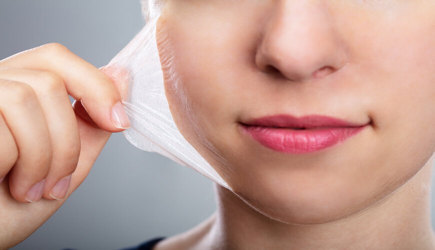 Bước 7: Dưỡng da như bình thường
