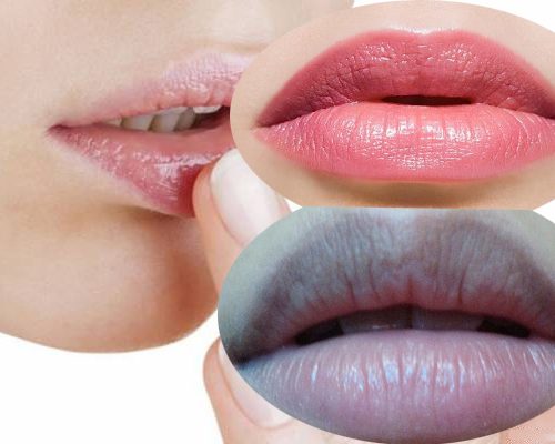 THE LAMM COSMECEUTICALS sẽ mách bạn 10 cách trị thâm môi đơn giản và hiệu quả tại nhà.