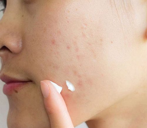 Đọc ngay bài viết nếu bạn chưa biết đến 7 mặt nạ cho da khô ngăn ngừa mất nước