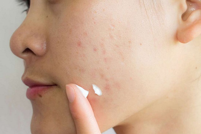 Đọc ngay bài viết nếu bạn chưa biết đến 7 mặt nạ cho da khô ngăn ngừa mất nước