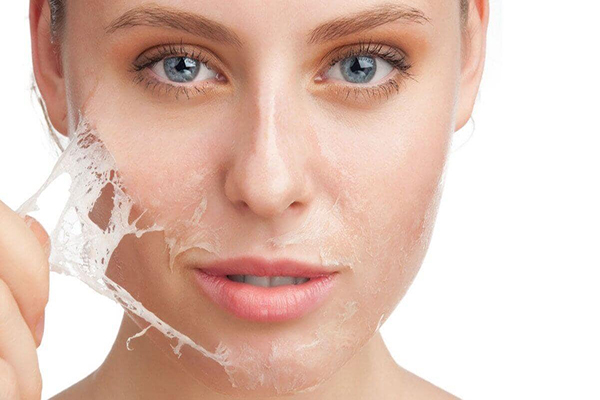 Da mặt bị bong tróc nguyên nhân do đâu?
