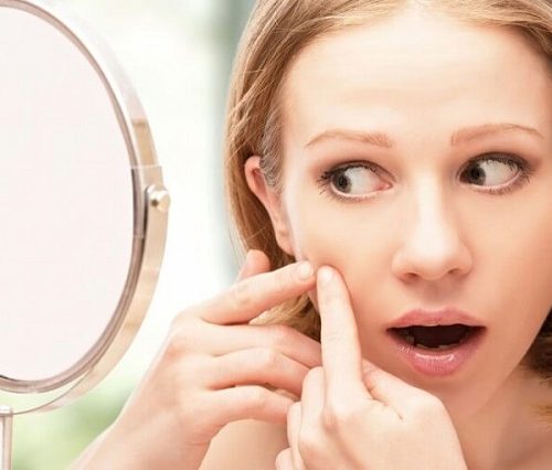 Chỉ bạn đọc xử lý sau khi nặn mụn nên làm gì để da nhanh hồi phục?