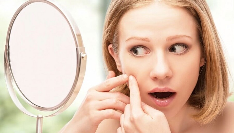 Chỉ bạn đọc xử lý sau khi nặn mụn nên làm gì để da nhanh hồi phục?
